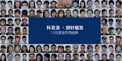 国内哪家种植头发的医院效果好 图片 1