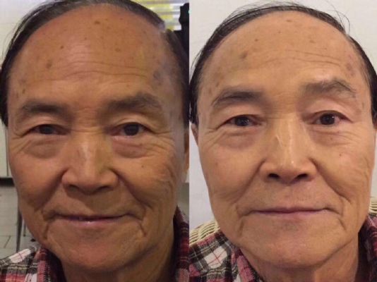 2分鐘洗出膠原蛋白質 图片 4