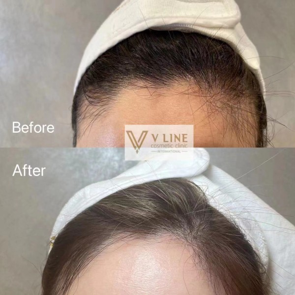V LINE國際醫美診所 photo 8