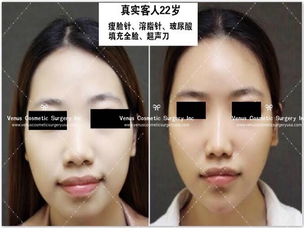 韓美明星整型中心 图片 3