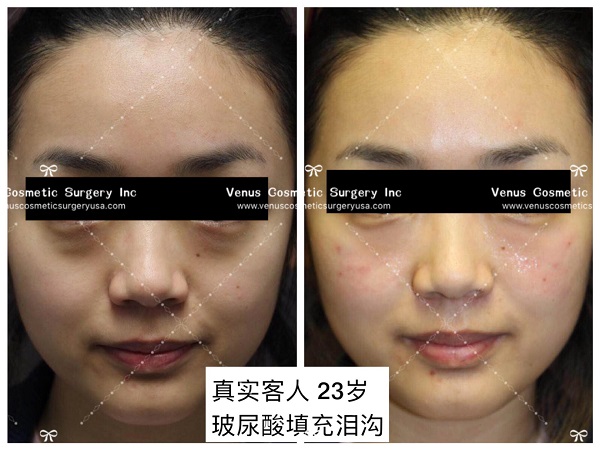 韓美明星整型中心 图片 4