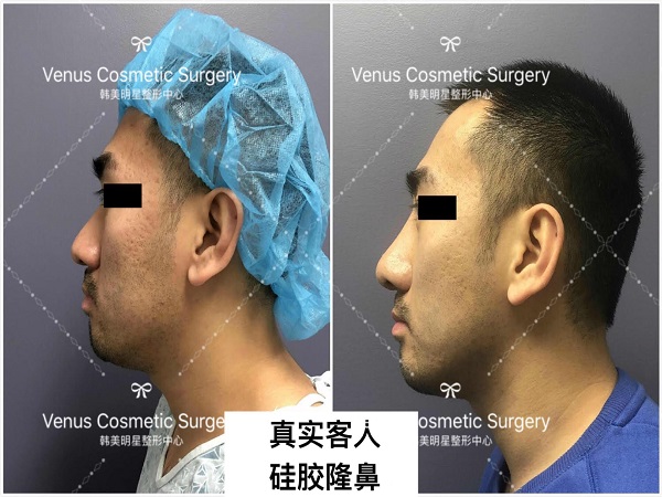 韓美明星整型中心 图片 6