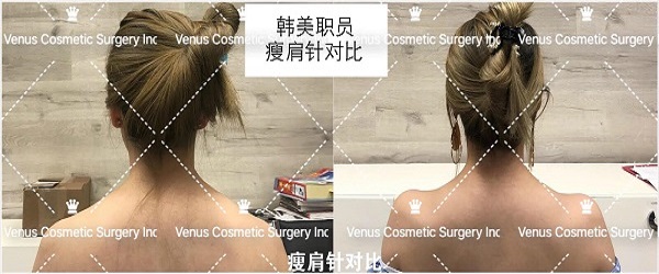 韓美明星整型中心 图片 5