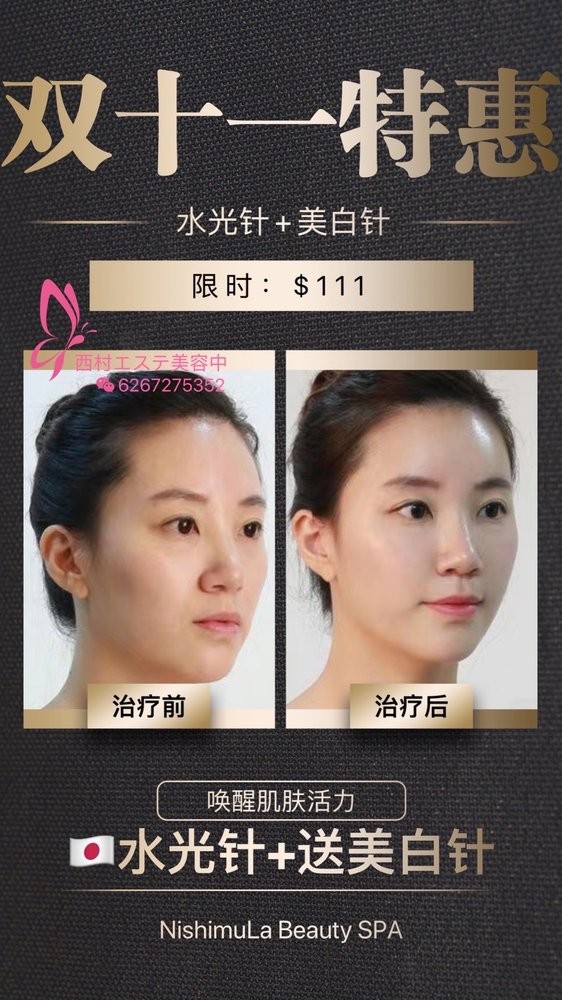 Nishimula Medical Spa photo 5