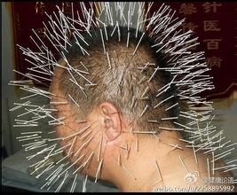 湖南中医针灸减肥知识系统培训班 photo 4