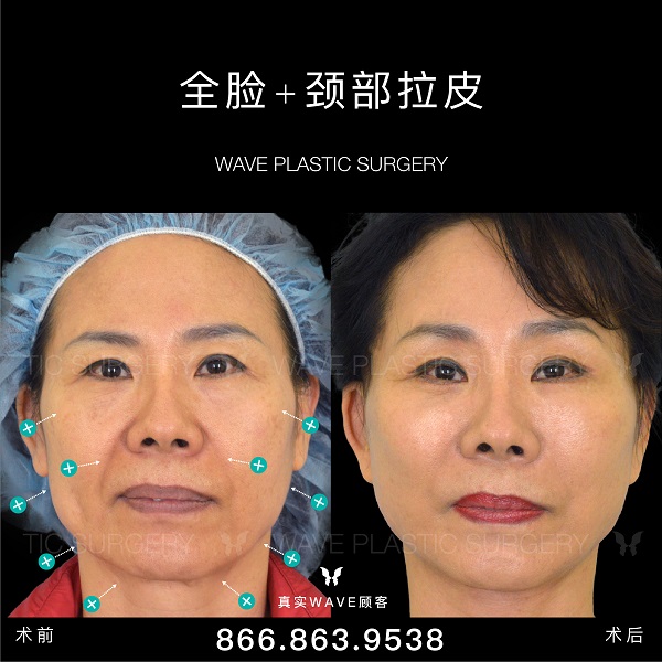 WAVE美亦恆整型外科 photo 4