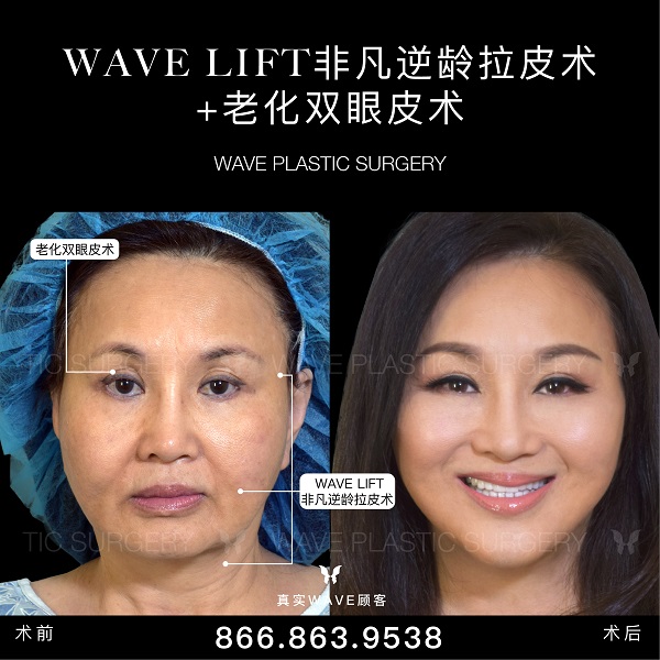 WAVE美亦恆整型外科 photo 8