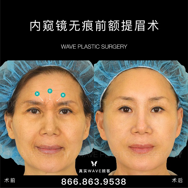 WAVE美亦恆整型外科 photo 6