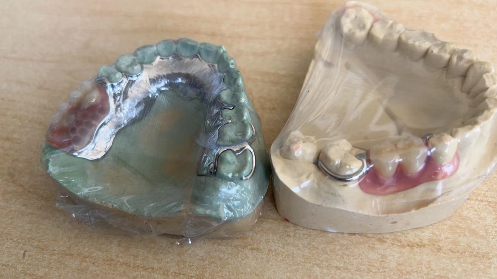 免费为广大客户提供上门检查有关牙齿问题服务。