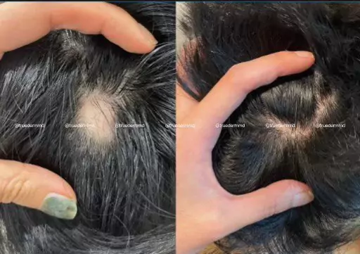 美國皮膚科學會認證─宋凱文醫師