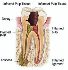 梁家豪牙科根管治療專科