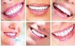 Periodonyics specialist.Dental implants